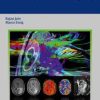 Ebook Brain Tumor Imaging