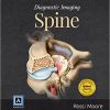 Ebook Diagnostic Imaging: Spine, 3e