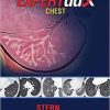 Ebook EXPERTddx: Chest
