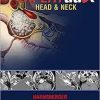 Ebook EXPERTddx: Head and Neck
