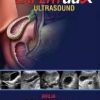 Ebook EXPERTddx: Ultrasound