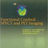 Ebook Functional Cerebral SPECT and PET Imaging / Edition 4