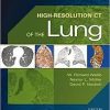 Ebook High-Resolution CT of the Lung 5th Edition
