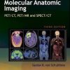 Ebook Molecular Anatomic Imaging: PET-CT and SPECT-CT Integrated Modality Imaging Edition 2