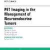 Ebook PET Imaging in the Management of Neuroendocrine Tumors, An Issue of PET Clinics