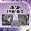 Ebook Radiology Case Review Series: Brain Imaging 1st Edition