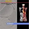 Ebook Specialty Imaging: PET/CT: Oncologic Imaging with Correlative Diagnostic CT