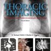 Ebook Thoracic Imaging: Pulmonary and Cardiovascular Radiology, 2nd Edition
