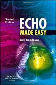 Echo Made Easy, 2e