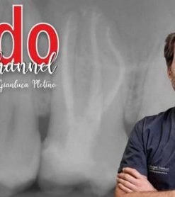 Endo Channel: The Excellence in Endodontic Treatment Made Easy