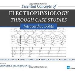 Essential Concepts of Electrophysiology through Case Studies: Intracardiac EGMs (PDF)