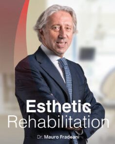 Esthetic Rehabilitation: Esthetic and Functional Integration of the Prosthetic Rehabilitation (CME VIDEOS)
