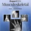 ExpertDDx: Musculoskeletal 2nd Edition