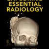 Exploring Essential Radiology (Videos)