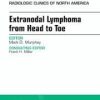 Extranodal Lymphoma from Head to Toe, An Issue of Radiologic Clinics of North America,: 54 (The Clinics: Radiology)