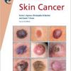 Fast Facts: Skin Cancer, 2e