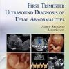 First Trimester Ultrasound Diagnosis of Fetal Abnormalities 1st Edition