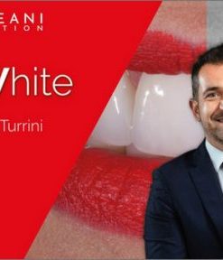 Follow White International – Tooth Whitening