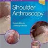 Gartsman’s Shoulder Arthroscopy, 3e (PDF)