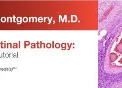 Expert Series with Elizabeth Montgomery, M.D.: Gastrointestinal Pathology: A One-On-One Tutorial 2018 (CME VIDEOS)