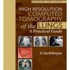 High Resolution Computed Tomography of the Lungs: A Practical Guide 2nd Edition (Rare eBooks)