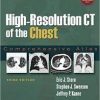 High-Resolution CT of the Chest: Comprehensive Atlas, 3rd Edition