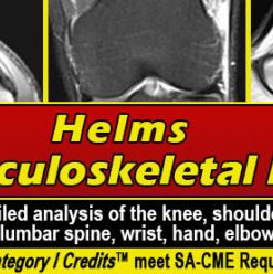 Helms Musculoskeletal MRI 2021 (CME VIDEOS)