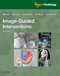 Image-Guided Interventions: Expert Radiology Series, 1e
