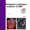 Imagerie cardiaque : scanner et IRM 2ème édition