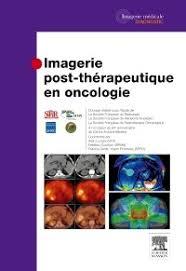 Imagerie post thérapeutique en oncologie