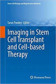 Imaging in Stem Cell Transplant and Cell-based Therapy (Stem Cell Biology and Regenerative Medicine) 1st ed. 2017 Edition