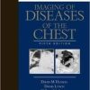 Imaging of Diseases of the Chest: Expert Consult – Online and Print, 5e