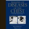 Imaging of Diseases of the Chest: Expert Consult – Online and Print, 5th