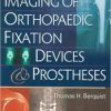 Imaging of Orthopaedic Fixation Devices and Prostheses Retail PDF