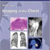 Imaging of the Chest, 2-Volume Set: Expert Radiology Series, 1e