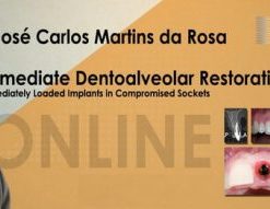 Immediate Dentoalveolar Restoration (IDR) Level 1