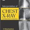 Interpretation of Chest X-ray: An Illustrated Companion