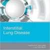 Interstitial Lung Disease, 1e 1st Edition
