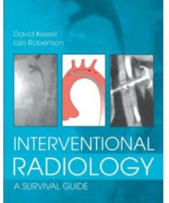Interventional Radiology: A Survival Guide, 4e