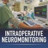 Intraoperative Neuromonitoring (EPUB)