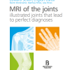 MRI of the Joints (PDF Book)