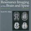 Magnetic Resonance Imaging of the Brain and Spine (2 Volume Set)