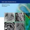 MR Neuroimaging: Brain, Spine, and Peripheral Nerves-Original PDF