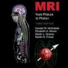 MRI from Picture to Proton 3rd Edition