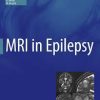 MRI in Epilepsy (Medical Radiology)