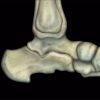 MRIOnline MRI Mastery Series: Ankle 2017 (CME VIDEOS)