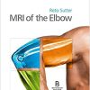MRI of the Elbow (Englisch) Gebundene Ausgabe – 21. Februar 2018