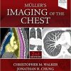 Muller’s Imaging of the Chest: Expert Radiology Series 2n