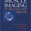Muscle Imaging in Health and Disease