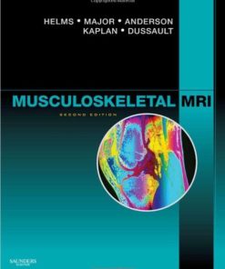 Musculoskeletal MRI, 2e